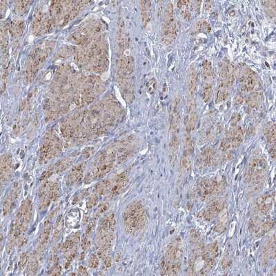 Immunohistochemistry-Paraffin: PAPSS1 Antibody [NBP2-13730]