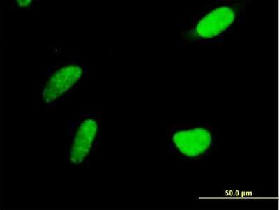 Immunocytochemistry/ Immunofluorescence: PAPSS2 Antibody [H00009060-B01P]