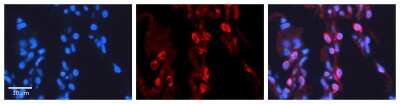 Immunohistochemistry: PAPSS2 Antibody [NBP1-55135]