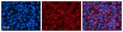 Immunohistochemistry: PAPSS2 Antibody [NBP1-55135]