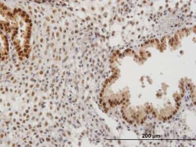 Immunohistochemistry-Paraffin: PAPSS2 Antibody [H00009060-B01P]