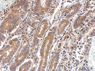 Immunohistochemistry-Paraffin: PAPSS2 Antibody [NBP1-33726]
