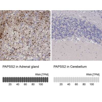 Immunohistochemistry-Paraffin: PAPSS2 Antibody [NBP3-17062]