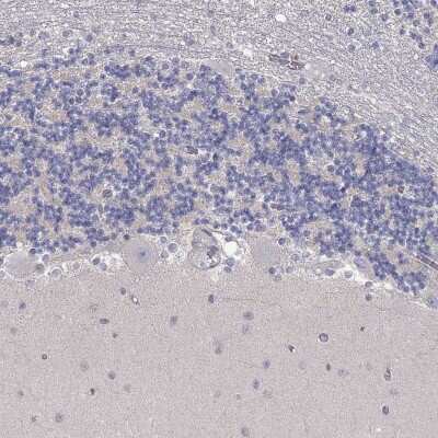 Immunohistochemistry-Paraffin: PAPSS2 Antibody [NBP3-17062]
