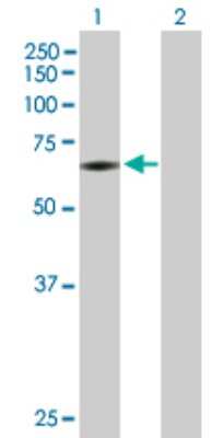 Western Blot: PAPSS2 Antibody [H00009060-B01P]