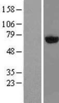 Western Blot: PAPSS2 Overexpression Lysate [NBL1-14096]