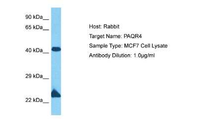 Western Blot: PAQR4 Antibody [NBP2-83356]