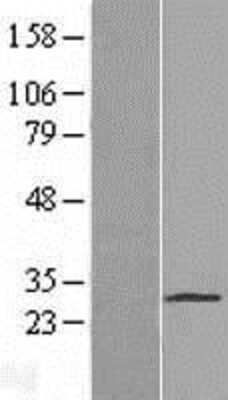 Western Blot: PAQR4 Overexpression Lysate [NBL1-14097]