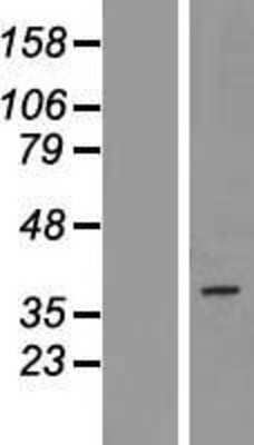 Western Blot: PAQR5 Overexpression Lysate [NBP2-09350]