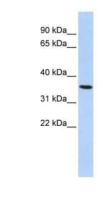 Western Blot: PAQR6 Antibody [NBP1-59477]