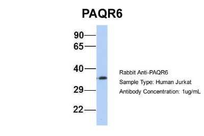 Western Blot: PAQR6 Antibody [NBP1-59477]