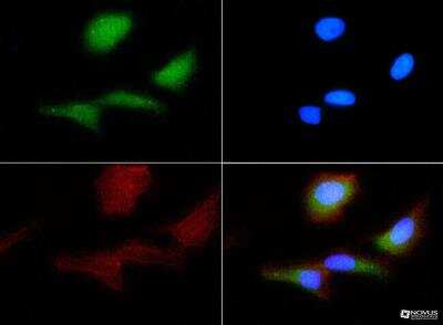 Immunocytochemistry/ Immunofluorescence: PAR1/Thrombin Receptor Antibody (N2-11) [NBP1-71770]