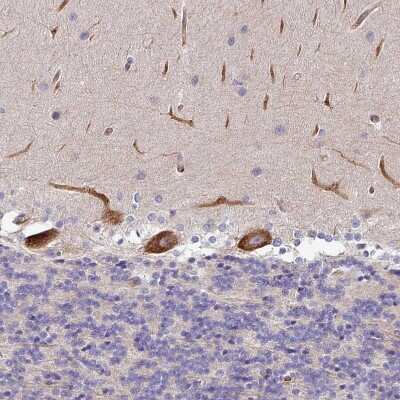 Immunohistochemistry-Paraffin: PARD6A Antibody [NBP2-38487]