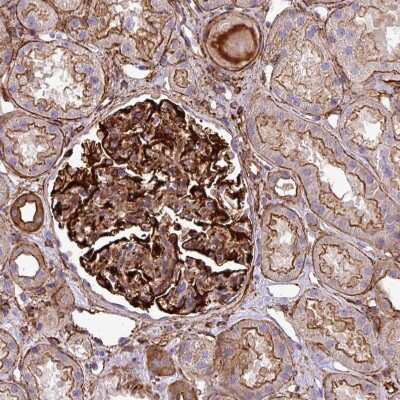 Immunohistochemistry-Paraffin: PARD6A Antibody [NBP2-38487]