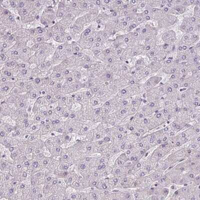 Immunohistochemistry-Paraffin: PARD6A Antibody [NBP2-38487]