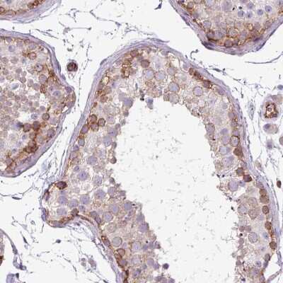 Immunohistochemistry-Paraffin: PARD6A Antibody [NBP2-38487]
