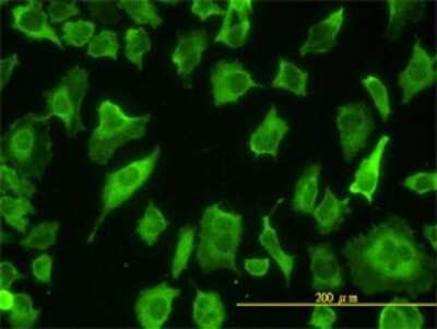 Immunocytochemistry/ Immunofluorescence: PARD6B Antibody (1C4) [H00084612-M01]