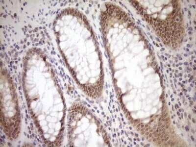 Immunohistochemistry-Paraffin: PARG Antibody (OTI6F4) [NBP2-46320]