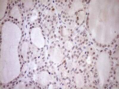 Immunohistochemistry-Paraffin: PARG Antibody (OTI6F4) [NBP2-46320]