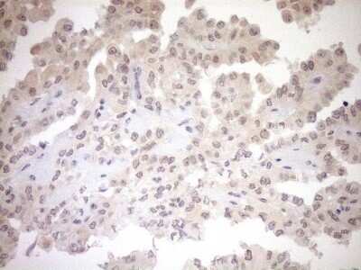 Immunohistochemistry-Paraffin: PARG Antibody (OTI6F4) [NBP2-46320]