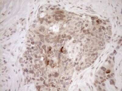 Immunohistochemistry-Paraffin: PARG Antibody (OTI6F4) [NBP2-46320]