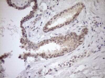 Immunohistochemistry-Paraffin: PARG Antibody (OTI6F4) [NBP2-46320]