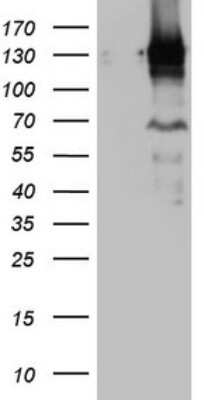 Western Blot: PARG Antibody (OTI6F4) [NBP2-46320]