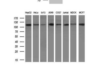Western Blot: PARG Antibody (OTI6F4) [NBP2-46320]