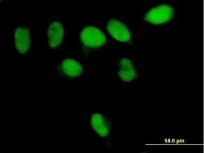 Immunocytochemistry/ Immunofluorescence: PARG Antibody [H00008505-B01P]