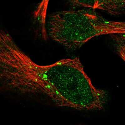 Immunocytochemistry/ Immunofluorescence: PARG Antibody [NBP1-89450]