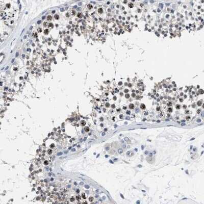 Immunohistochemistry-Paraffin: PARG Antibody [NBP1-89450]
