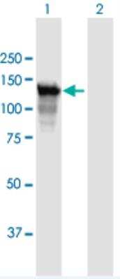 Western Blot: PARG Antibody [H00008505-B01P]