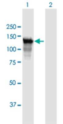 Western Blot: PARG Antibody [H00008505-B01P]