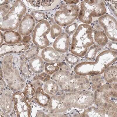 Immunohistochemistry-Paraffin: PARG1 Antibody [NBP1-87336]