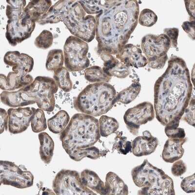 Immunohistochemistry-Paraffin: PARG1 Antibody [NBP1-87336]