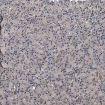 Immunohistochemistry-Paraffin: PARG1 Antibody [NBP1-87336]