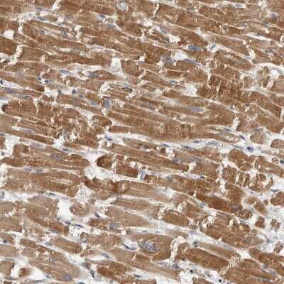 Immunohistochemistry-Paraffin: PARG1 Antibody [NBP1-87336]
