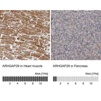 Immunohistochemistry-Paraffin: PARG1 Antibody [NBP1-87336]