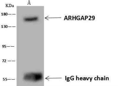 Immunoprecipitation: PARG1 Antibody [NBP3-12573]