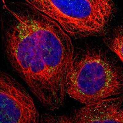 Immunocytochemistry/ Immunofluorescence: PARL Antibody [NBP1-80878]