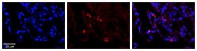 Immunohistochemistry: PARL Antibody [NBP1-59496]