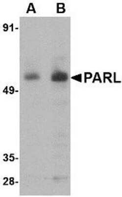 Western Blot: PARL AntibodyBSA Free [NBP1-76938]