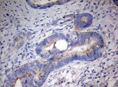 Immunohistochemistry: PARN Antibody (OTI4D12) [NBP2-46321]