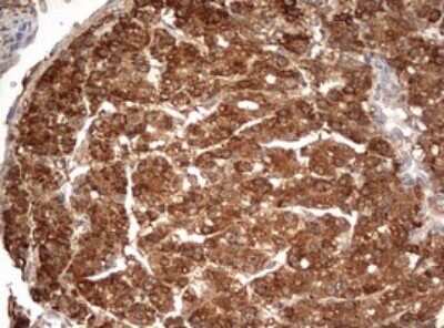 Immunohistochemistry: PARN Antibody (OTI4D12) [NBP2-46321]