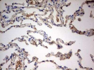Immunohistochemistry: PARN Antibody (OTI4D12) [NBP2-46321]