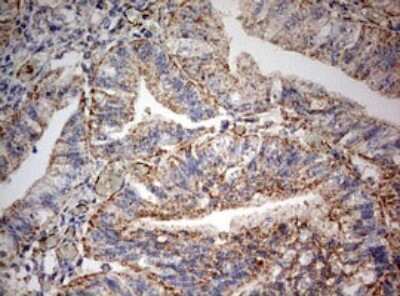Immunohistochemistry: PARN Antibody (OTI4D12) [NBP2-46321]