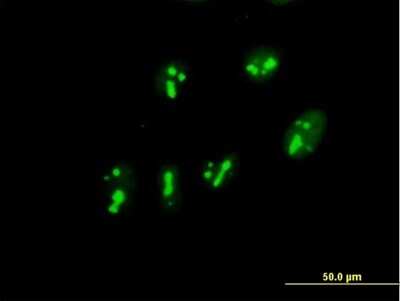 Immunocytochemistry/ Immunofluorescence: PARN Antibody [H00005073-B01P]