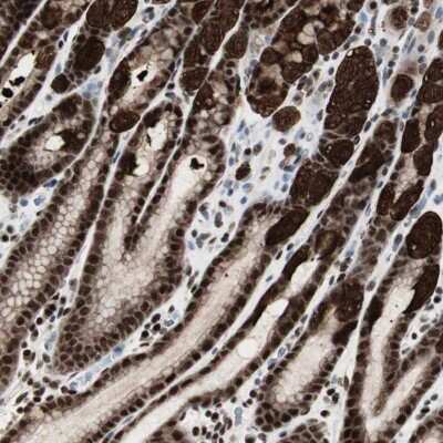 Immunohistochemistry-Paraffin: PARN Antibody [NBP1-84302]