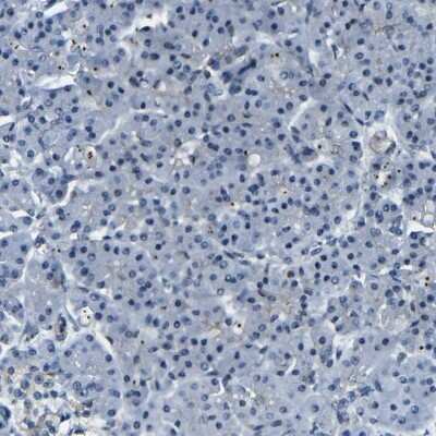 Immunohistochemistry-Paraffin: PARN Antibody [NBP1-84303]
