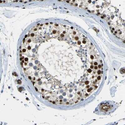 Immunohistochemistry-Paraffin: PARN Antibody [NBP1-84303]